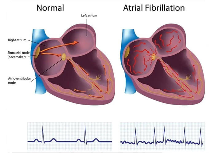 Cardiologist in Hyderabad