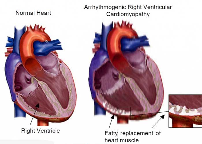 Best Cardiology Hospital in Hyderabad