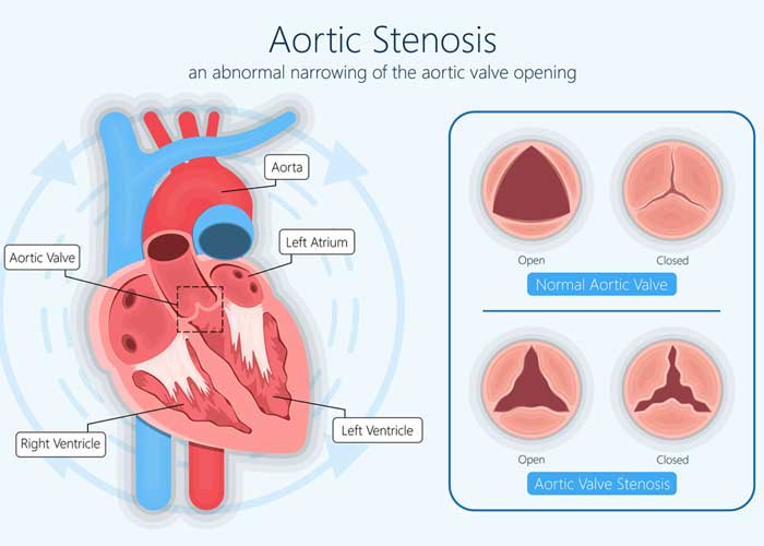 Heart Specialist Doctor in Hyderabad