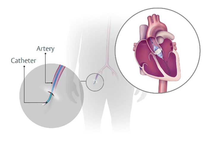 Heart Check Up