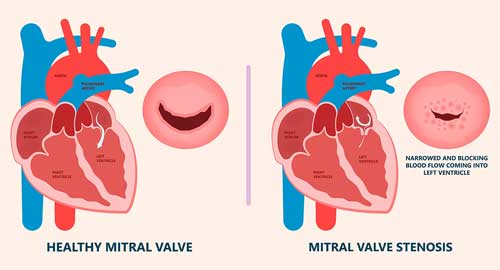 Best Heart Hospital in Hyderabad