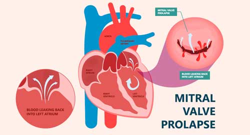 Best Cardiology Hospital Hyderabad
