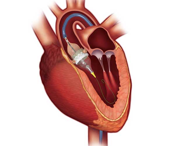 Consultant Interventional Cardiologist